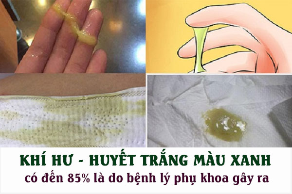 Huyet-trang-mau-xanh-2