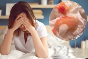 Khí hư dính máu là bị gì? Có nguy hiểm không?