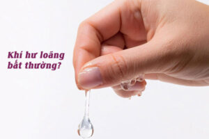 Khí hư loãng bất thường báo hiệu bệnh gì?