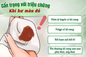 Khí hư màu đỏ nguyên nhân do đâu?