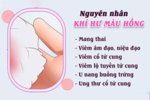 Nguyên nhân âm đạo ra dịch hồng, kèm mùi khó chịu