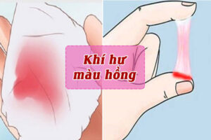 Khí hư màu hồng là dấu hiệu bệnh phụ khoa gì?