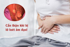 Nguyên nhân gây lở loét âm đạo là gì?