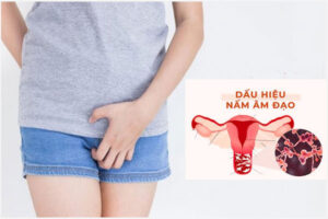 Bệnh nấm âm đạo: Biểu hiện và Nguy hiểm