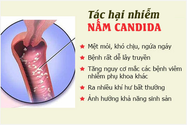 Nam-candida-2