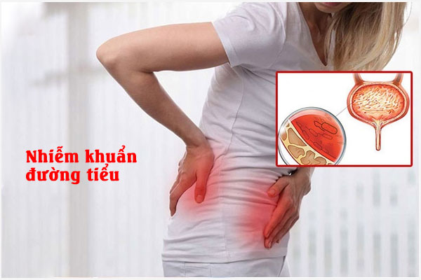 Nhiem-khuan-duong-tieu