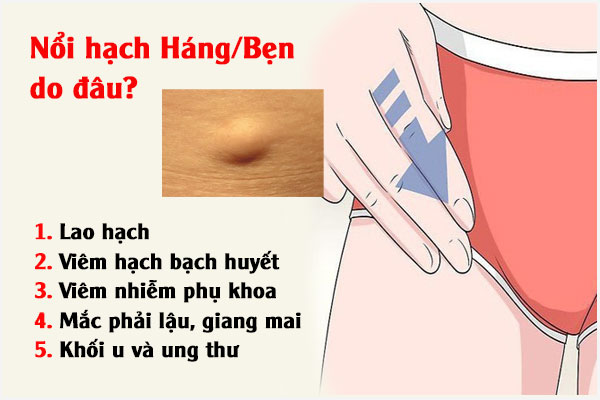 Noi-hach-hang-ben