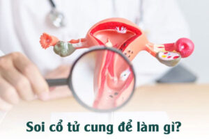 Soi cổ tử cung là gì? Khi nào nên soi cổ tử cung?