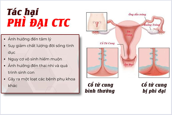 Tac-hai-phi-dai-co-tu-cung