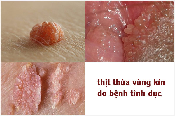 Thit-thua-vung-kin-1