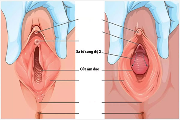 Thit-thua-vung-kin-2