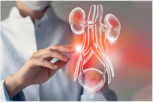 Bị viêm đường tiểu nữ giới phải làm sao?