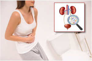 Tiểu rắt nữ là dấu hiệu của bệnh gì?