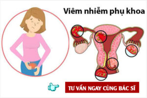 Tư vấn các bệnh vùng kín nữ: Biểu hiện và Cách khắc phục hiệu quả