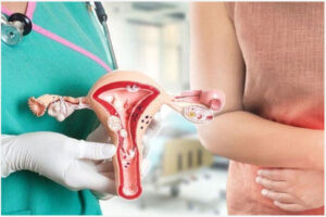 Cách điều trị viêm cổ tử cung hiệu quả và an toàn