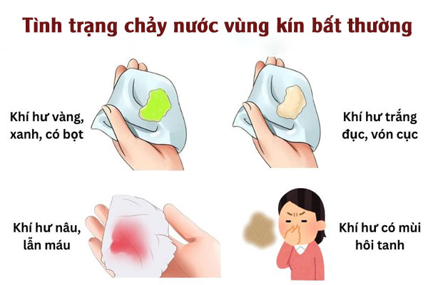 Vung-kin-chay-nuoc-1
