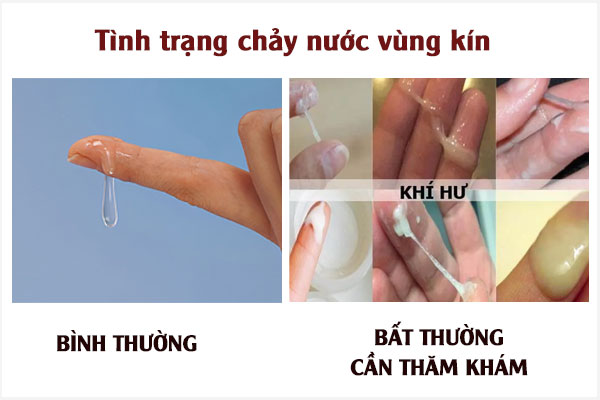 Vung-kin-chay-nuoc-2