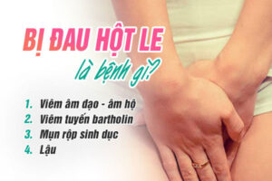 Bị đau hột le là bị gì? Cách khắc phục hiệu quả