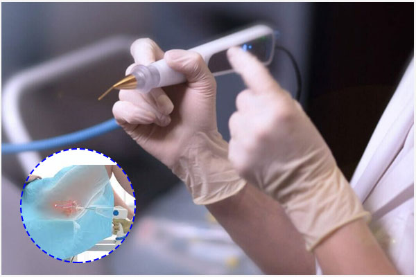 Dot-dien-viem-lo-tuyen-co-tu-cung