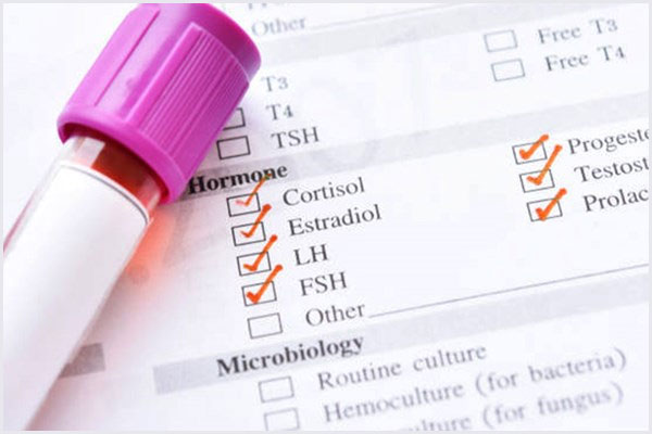 Kham-xet-nghiem-noi-tiet-to