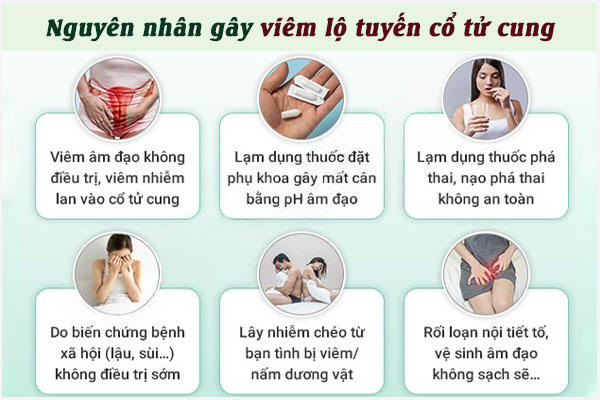 Nguyen-nhan-gay-viem-lo-tuyen-co-tu-cung