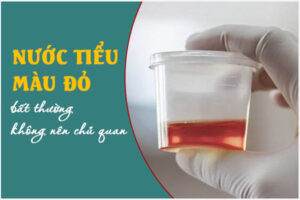 Nước tiểu màu đỏ bất thường là bị gì? Có sao không?