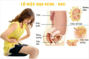 Sưng lỗ tiểu, lỗ niệu đạo có sao không? Cách khắc phục hiệu quả