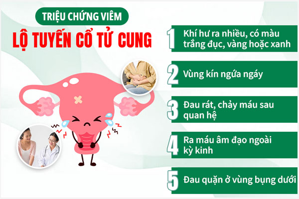 Trieu-chung-viem-lo-tuyen-co-tu-cung