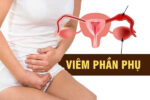 Viem-phan-phu-2