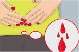 Không tới tháng mà ra máu dấu hiệu nguy hiểm chớ có chủ quan!