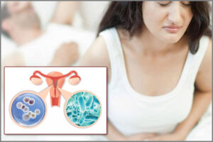 Quan hệ xong bị đái buốt ở nữ là bị gì? Cách khắc phục hiệu quả?